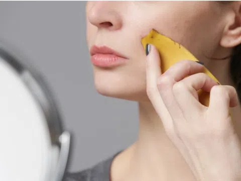 Vỏ chuối - 'thần dược' để làn da của bạn trẻ mãi không già